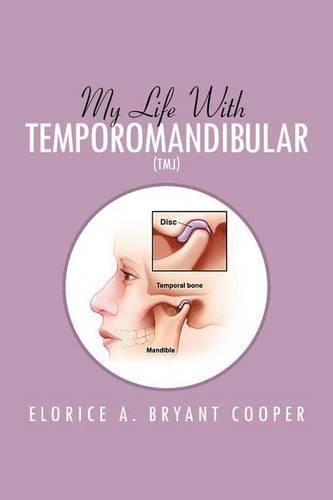 My Life with Temporomandibular (Tmj): Living with Tmj