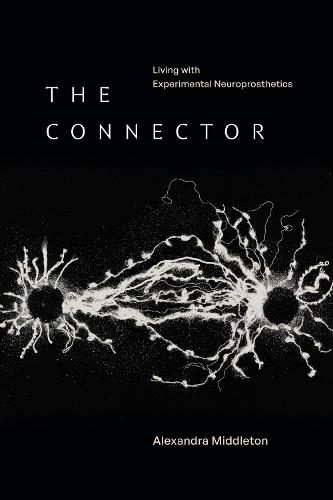 The Connector: Living with Experimental Neuroprosthetics