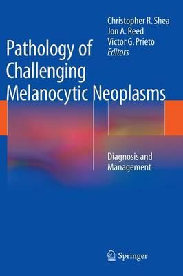Pathology of Challenging Melanocytic Neoplasms: Diagnosis and Management