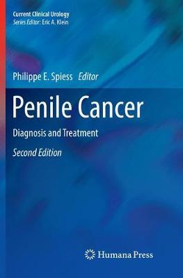 Penile Cancer: Diagnosis and Treatment