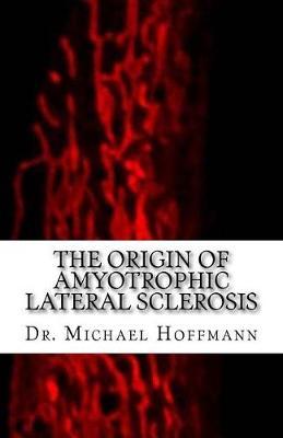 The Origin of Amyotrophic Lateral Sclerosis