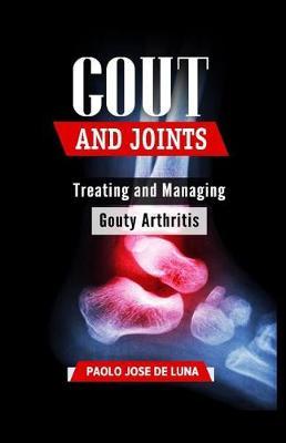 Gout And Joints: Treating and Managing Gouty Arthritis