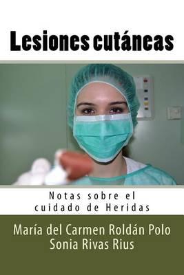 Lesiones cutaneas: Notas sobre el cuidado de Heridas