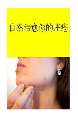 Cure Your Acne Naturally (Chinese)