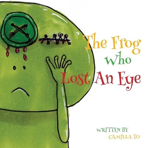 The Frog Who Lost An Eye: This is a story about a frog and his unfortunate encounters.