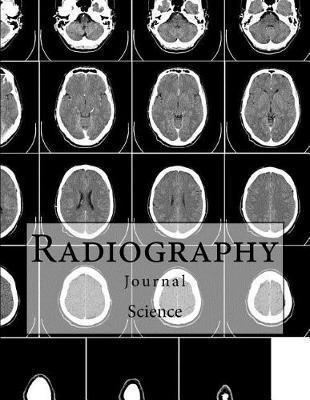 Radiography Journal: Science Journal with 150 lined pages