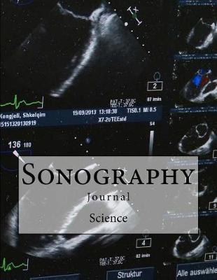 Sonography Journal: Journal with 150 lined pages