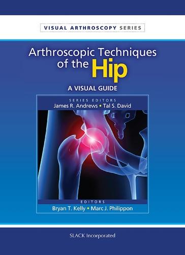 Arthroscopic Techniques of the Hip: A Visual Guide