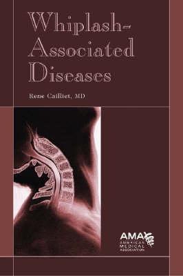 Whiplash-Associated Diseases