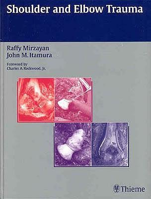 Shoulder and Elbow Trauma