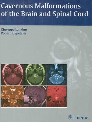Cavernous Malformations of the Brain and Spinal Cord
