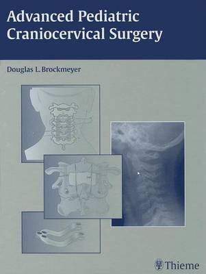 Advanced Pediatric Craniocervical Surgery