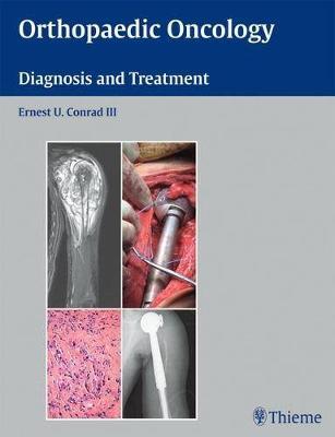 Orthopaedic Oncology: Diagnosis and Treatment