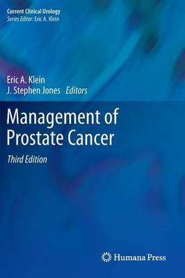 Management of Prostate Cancer