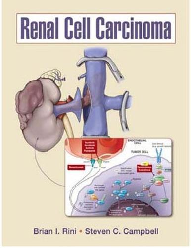 Renal Cell Carcinoma