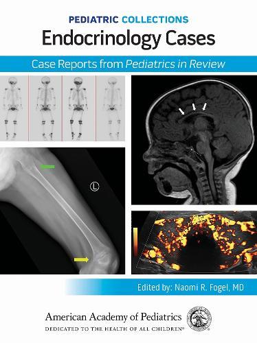 Endocrinology Cases: Case Reports from Pediatrics in Review