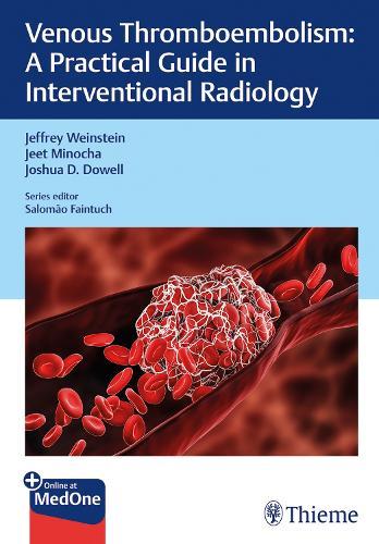 Venous Thromboembolism: A Practical Guide in Interventional Radiology