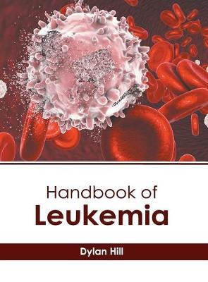 Handbook of Leukemia