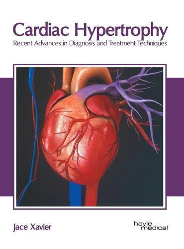 Cardiac Hypertrophy: Recent Advances in Diagnosis and Treatment Techniques