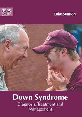 Down Syndrome: Diagnosis, Treatment and Management