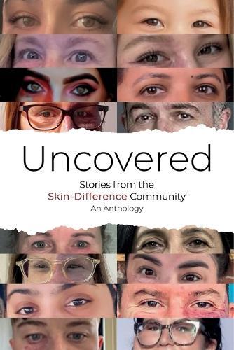 Uncovered: Stories from the Skin-Difference Community