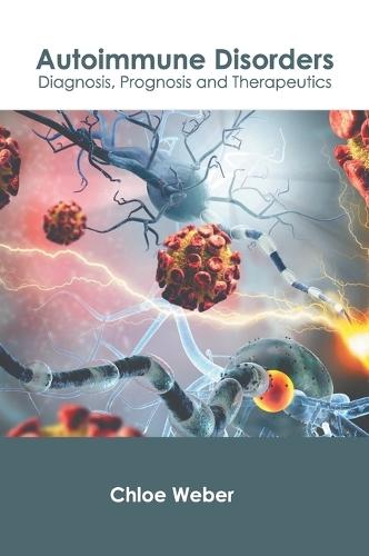 Autoimmune Disorders: Diagnosis, Prognosis and Therapeutics