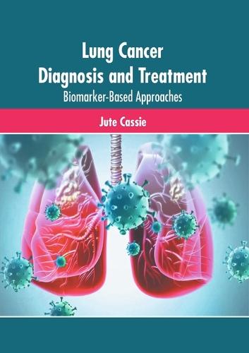 Lung Cancer Diagnosis and Treatment: Biomarker-Based Approaches
