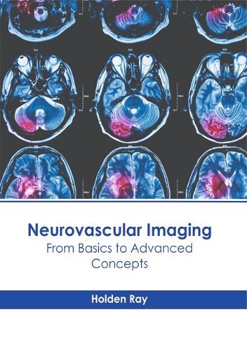 Neurovascular Imaging: From Basics to Advanced Concepts