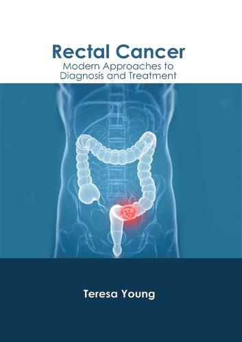 Rectal Cancer: Modern Approaches to Diagnosis and Treatment