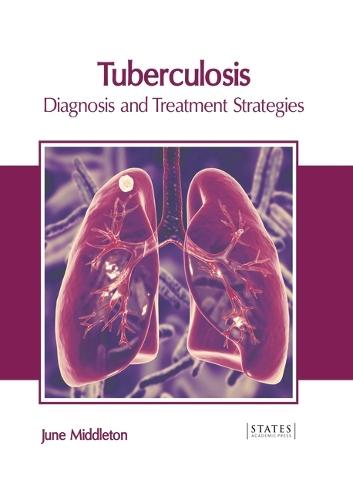 Tuberculosis: Diagnosis and Treatment Strategies