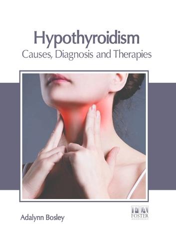 Hypothyroidism: Causes, Diagnosis and Therapies