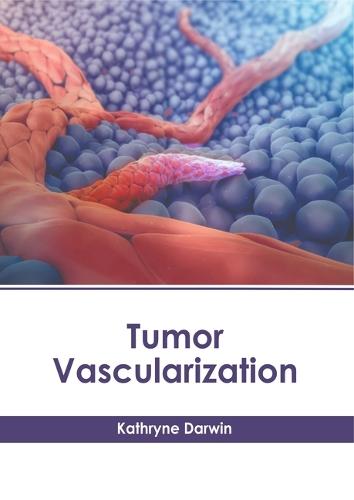 Tumor Vascularization