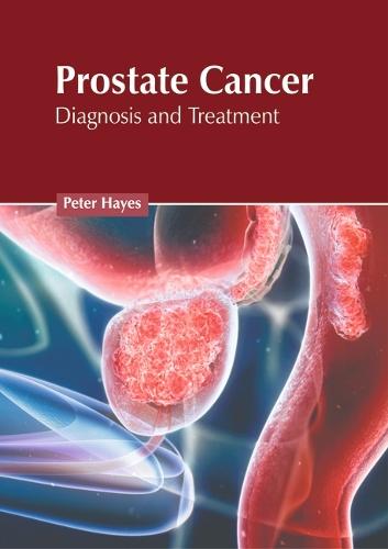 Prostate Cancer: Diagnosis and Treatment