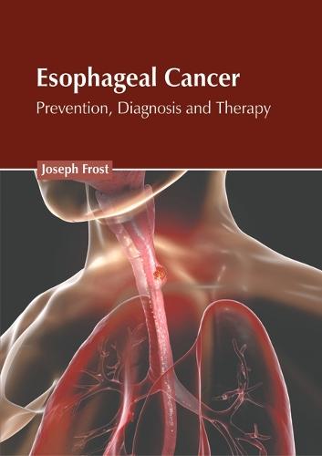 Esophageal Cancer: Prevention, Diagnosis and Therapy