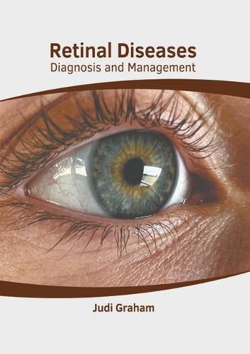 Retinal Diseases: Diagnosis and Management
