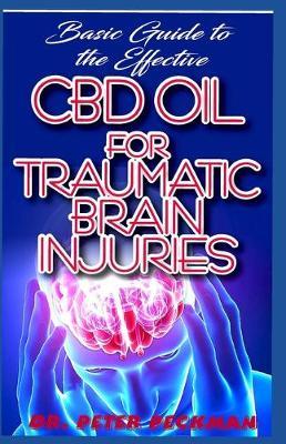 Basic Guide to the Effective CBD Oil for Traumatic Brain Injuries: Extensive guides on how CBD Oil cures brain injuries