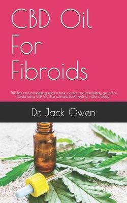 CBD Oil For Fibroids: The Best and complete guide on how to treat and completely get rid of fibroid using CBD Oil (The ultimate Book healing millions today)