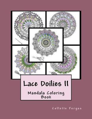 Lace Doilies II