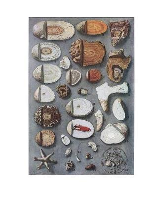 Kidney and Bladder Stones Notebook: 8-1/2x11 One Subject College Ruled Lined Paper 70 Sheets/140 Pages in White with White Cover Great for Class Especially Medical, Biology, & Life Science Lab, Lecture, and Residency Notes