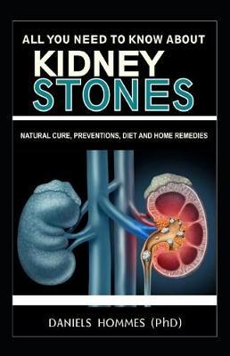 All You Need to Know about Kidney Stones Natural Cure, Diet and Home Remedies: Natural Cure, Preventions, Diet and Home Remedies
