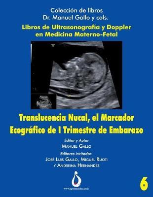 Translucencia Nucal, el marcador ecografico de I trimestre de Embarazo
