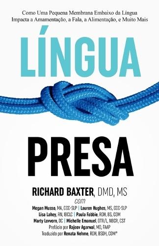 Língua Presa: Como Uma Pequena Membrana Embaixo da Língua Impacta a Amamentação, a Fala, a Alimentação, e Muito Mais