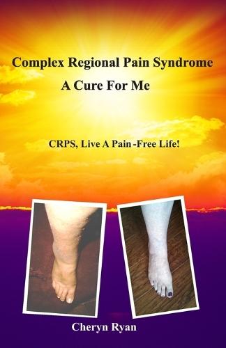 Complex Regional Pain Syndrome a Cure for Me: Crps, Live a Pain-Free Life!