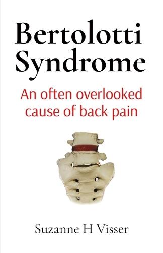 Bertolotti Syndrome: An often overlooked cause of chronic back pain