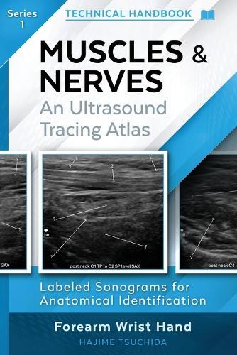 Technical Ultrasound Handbook - Muscles & Nerves: An Ultrasound Tracing Atlas (Series 1)