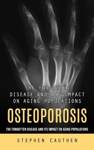 Osteoporosis: Quick and Effective Remedy for Stronger Bones (The Forgotten Disease and Its Impact on Aging Populations)