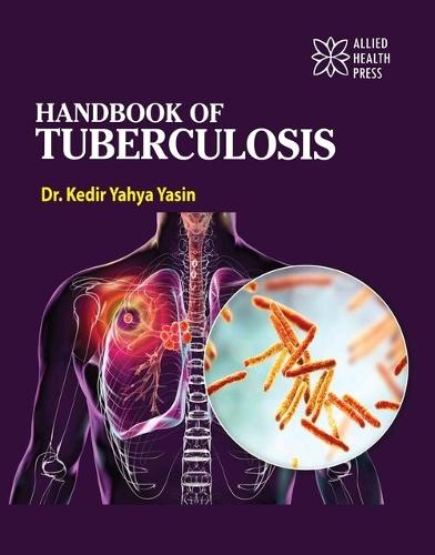 Handbook of Tuberculosis