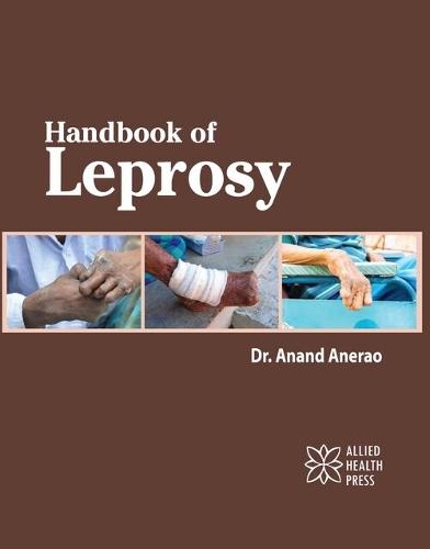 Handbook of Leprosy