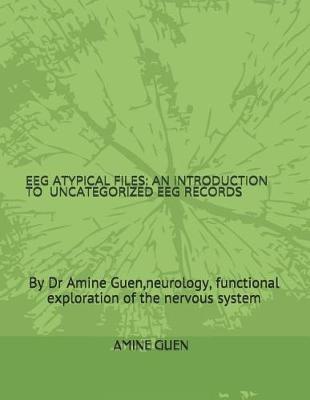 Eeg Atypical Files: An Introduction to Uncategorized Eeg Records