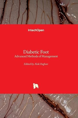 Diabetic Foot - Advanced Methods of Management: Advanced Methods of Management